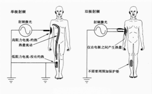 射頻美容儀,美容院美容設備,家用(yòng)美容儀