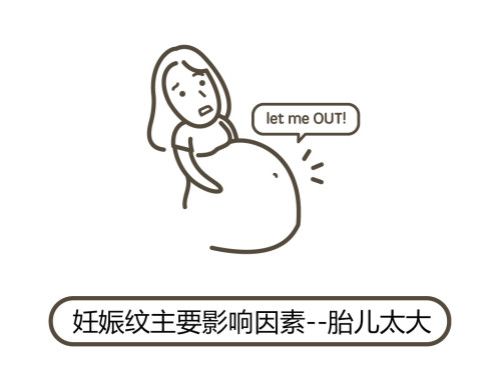 一文(wén)秒(miǎo)懂！妊娠紋肥胖紋保養、治療及預防全攻略